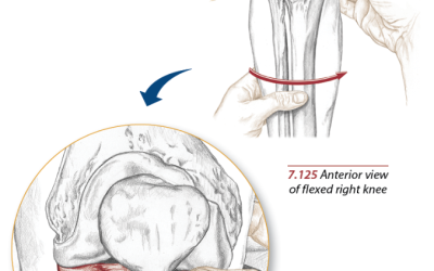 Meniscus Anatomy and Injuries