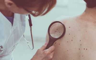 Understanding the Dangers of Skin Cancer: How Personal Trainers Can Advise Clients