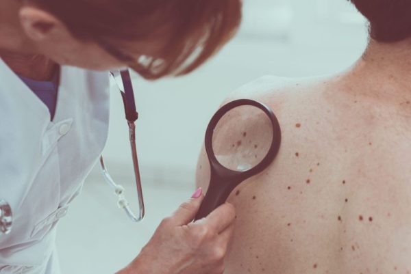 Understanding Skin Cancer.